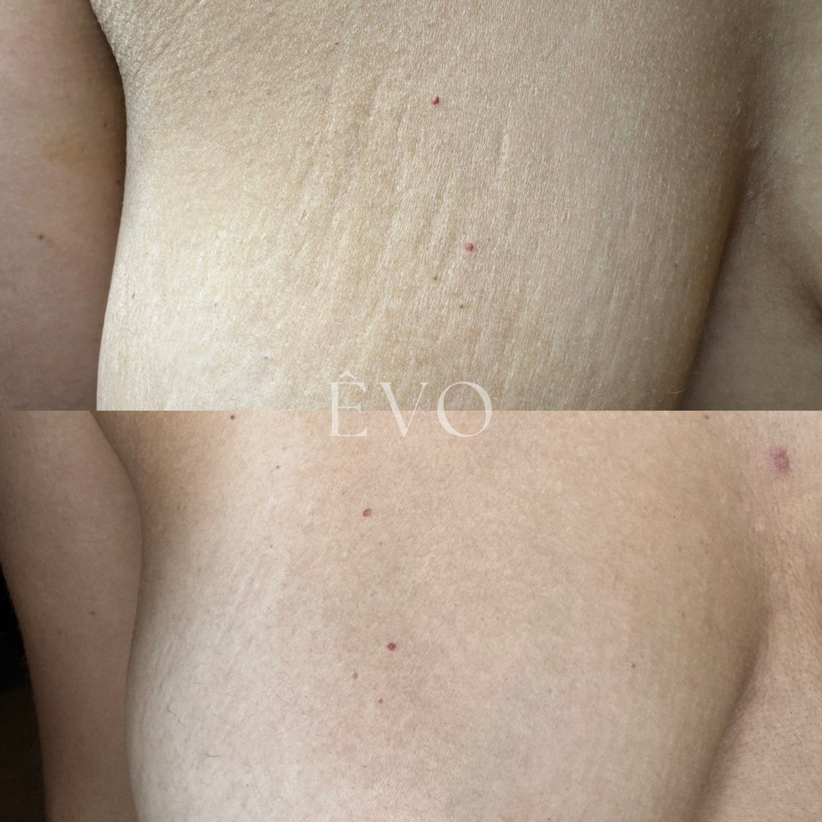 ÊVO gallery result