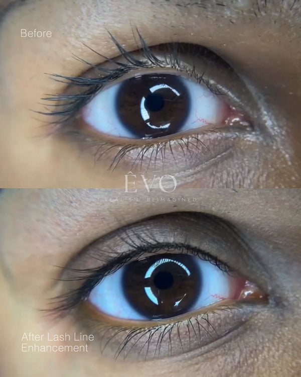 Lash Line Enhancement