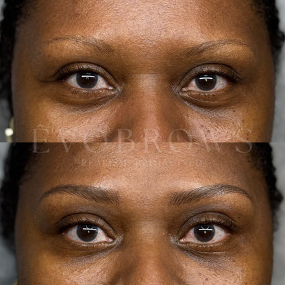 ÊvoBrows Combo