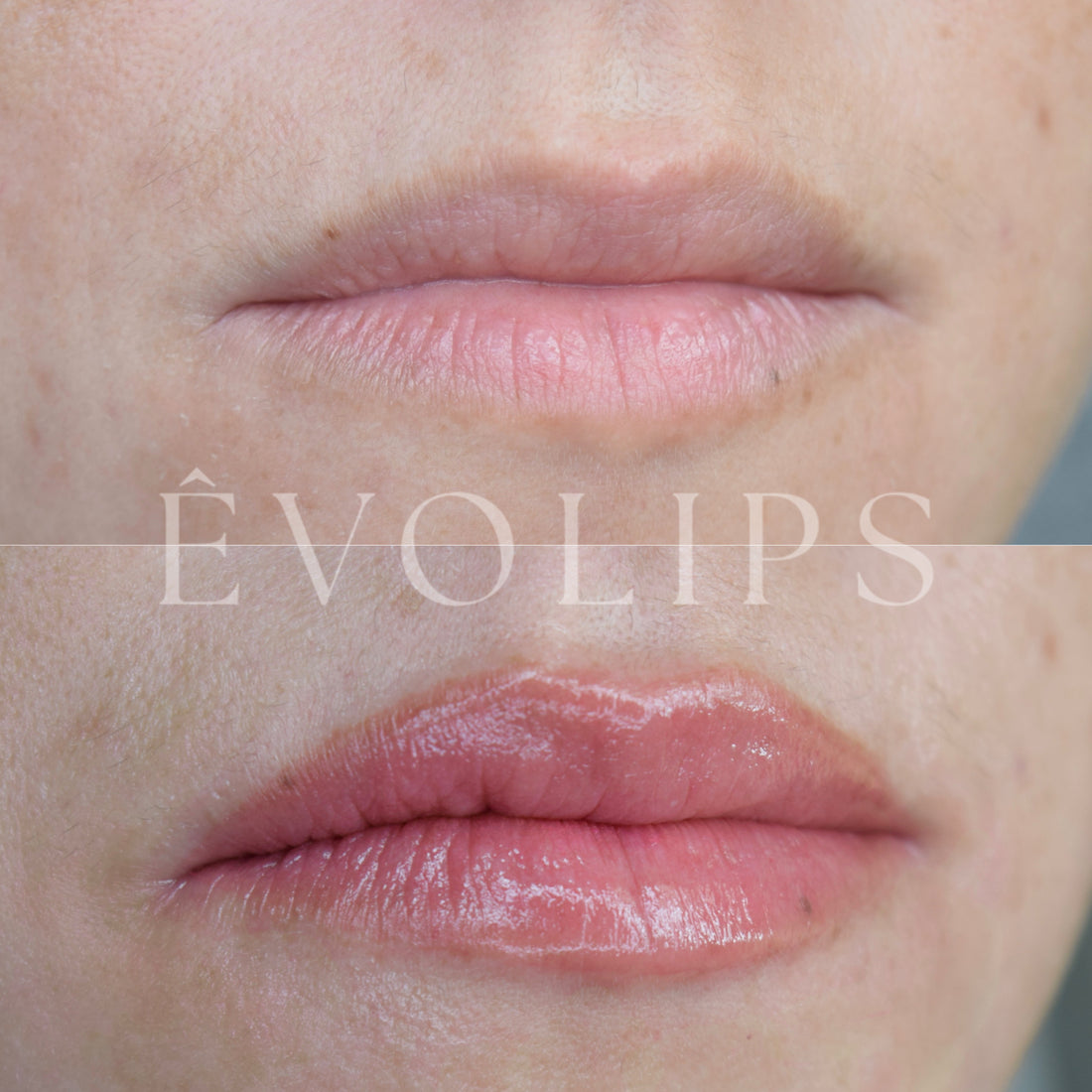 ÊvoLips