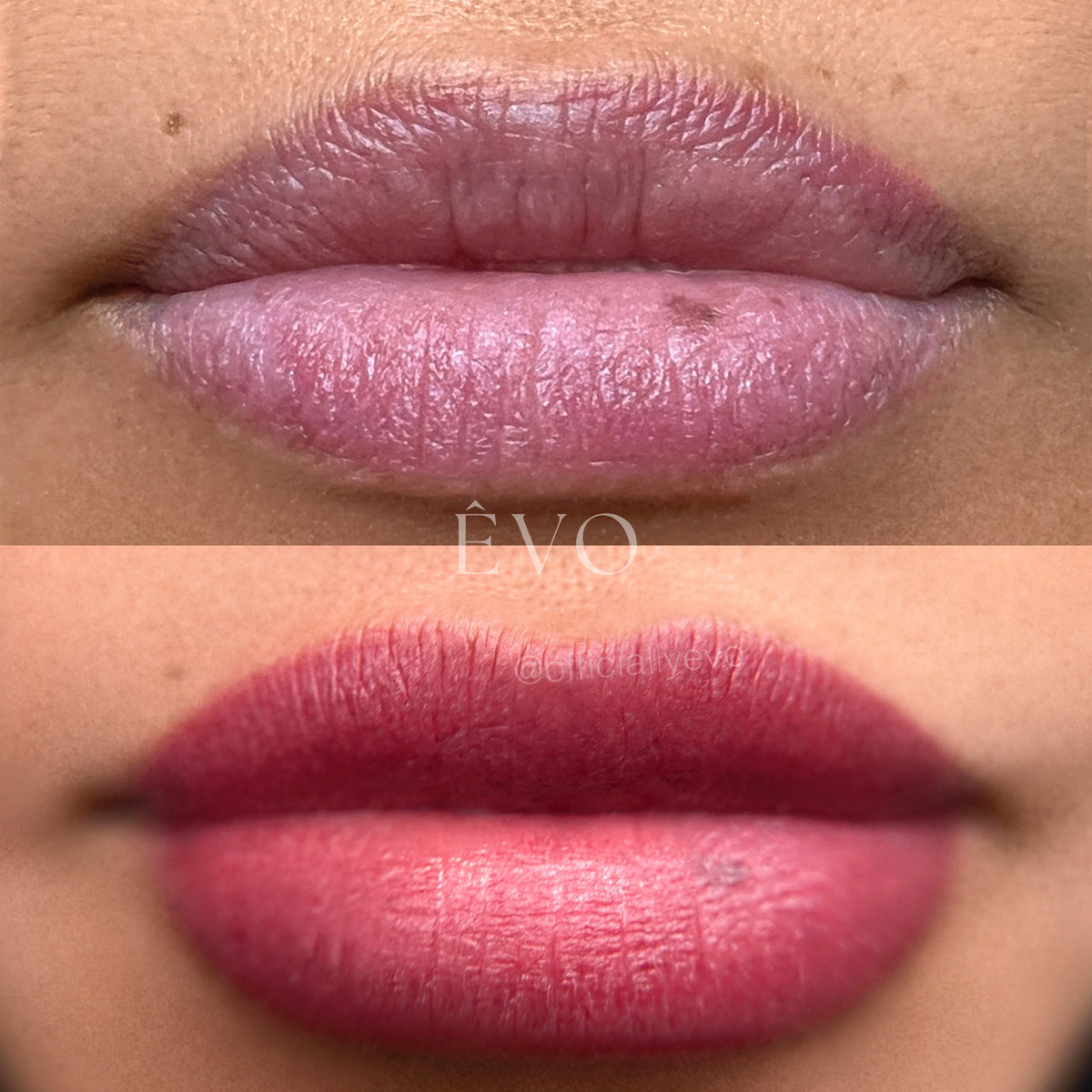 ÊVO gallery result