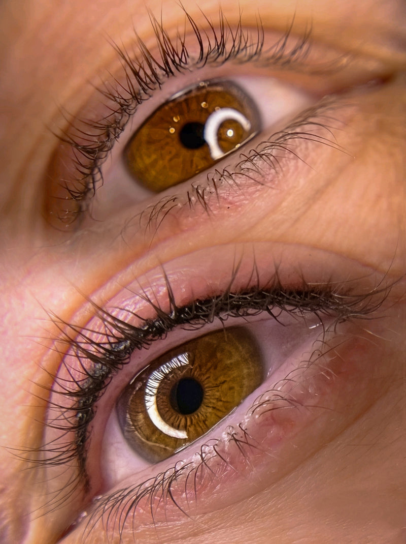 Eyes